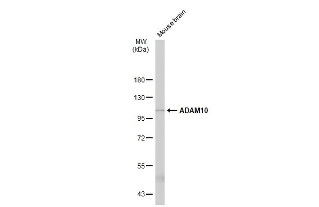 ADAM10 Antibody in Western Blot (WB)