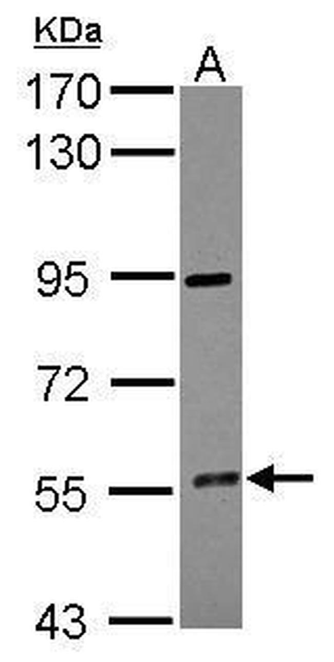 CYP4F12 Antibody in Western Blot (WB)