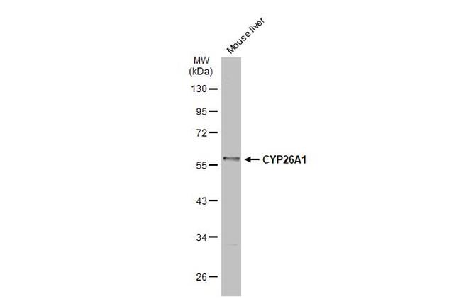 CYP26A1 Antibody in Western Blot (WB)