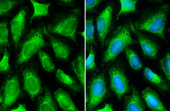 MTHFD2 Antibody in Immunocytochemistry (ICC/IF)