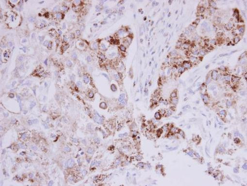 MTHFD2 Antibody in Immunohistochemistry (Paraffin) (IHC (P))