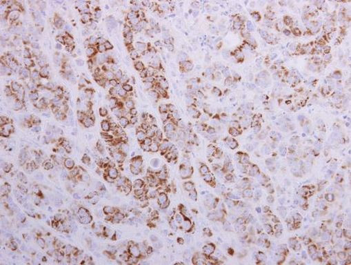 MTHFD2 Antibody in Immunohistochemistry (Paraffin) (IHC (P))