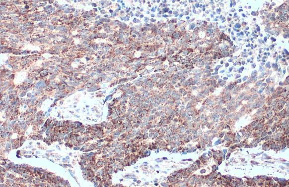 MTHFD2 Antibody in Immunohistochemistry (Paraffin) (IHC (P))