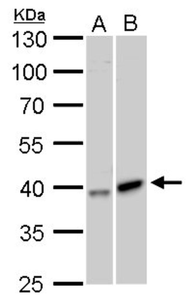 GALK1 Antibody in Western Blot (WB)