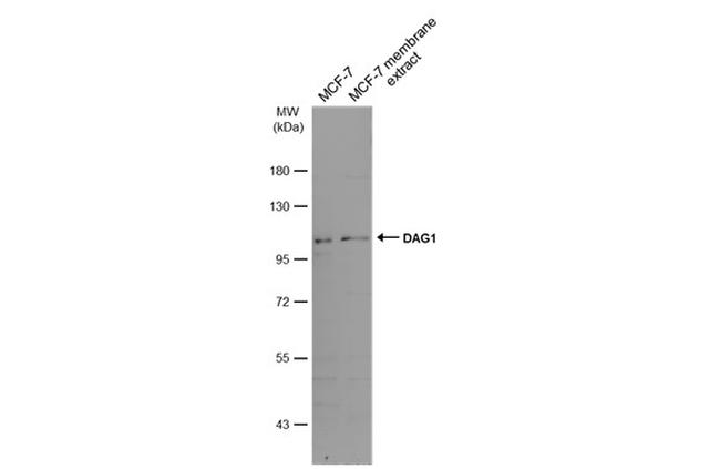 alpha Dystroglycan Antibody in Western Blot (WB)