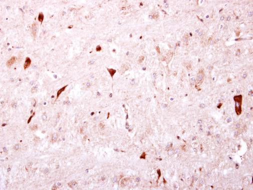 BTD Antibody in Immunohistochemistry (Paraffin) (IHC (P))