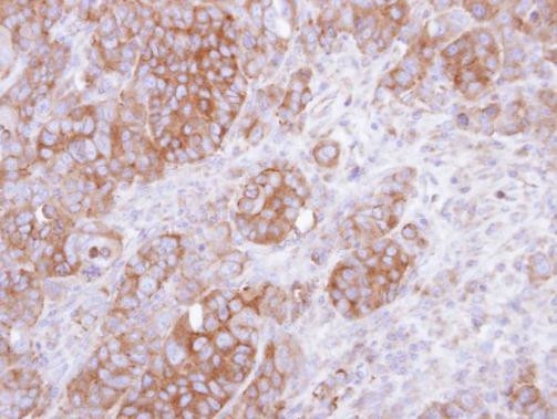 UST Antibody in Immunohistochemistry (Paraffin) (IHC (P))