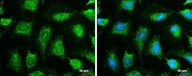 OGDH Antibody in Immunocytochemistry (ICC/IF)