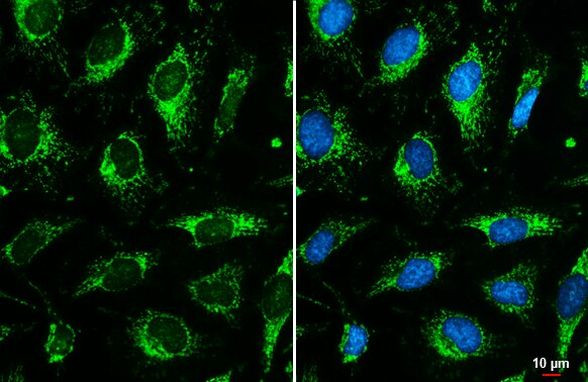 OGDH Antibody in Immunocytochemistry (ICC/IF)