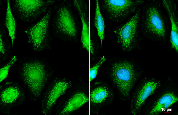 OGDH Antibody in Immunocytochemistry (ICC/IF)