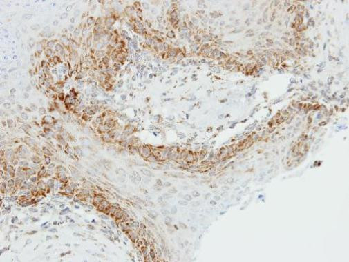 OGDH Antibody in Immunohistochemistry (Paraffin) (IHC (P))