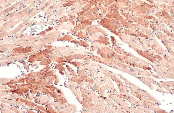 OGDH Antibody in Immunohistochemistry (Paraffin) (IHC (P))