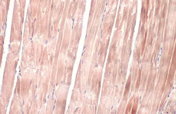 OGDH Antibody in Immunohistochemistry (Paraffin) (IHC (P))