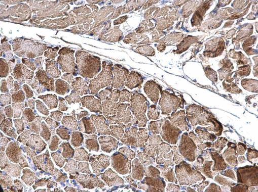 OGDH Antibody in Immunohistochemistry (Paraffin) (IHC (P))