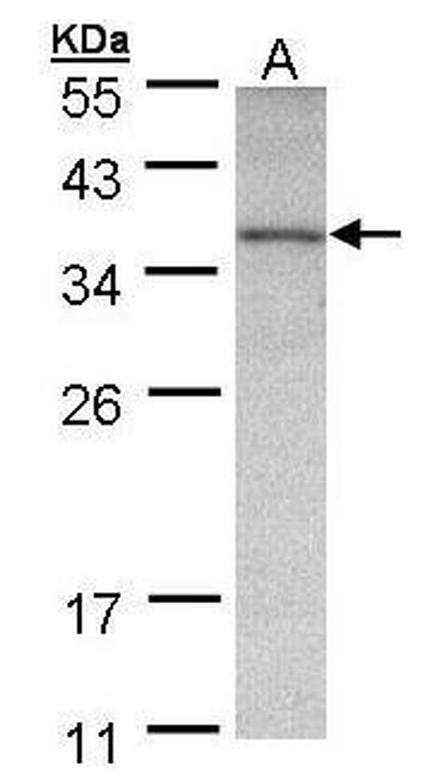 OTC Antibody in Western Blot (WB)