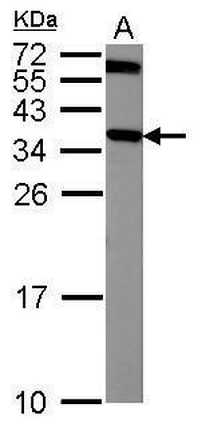 CRYM Antibody in Western Blot (WB)