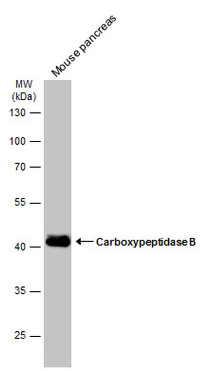 Carboxypeptidase B1 Antibody in Western Blot (WB)