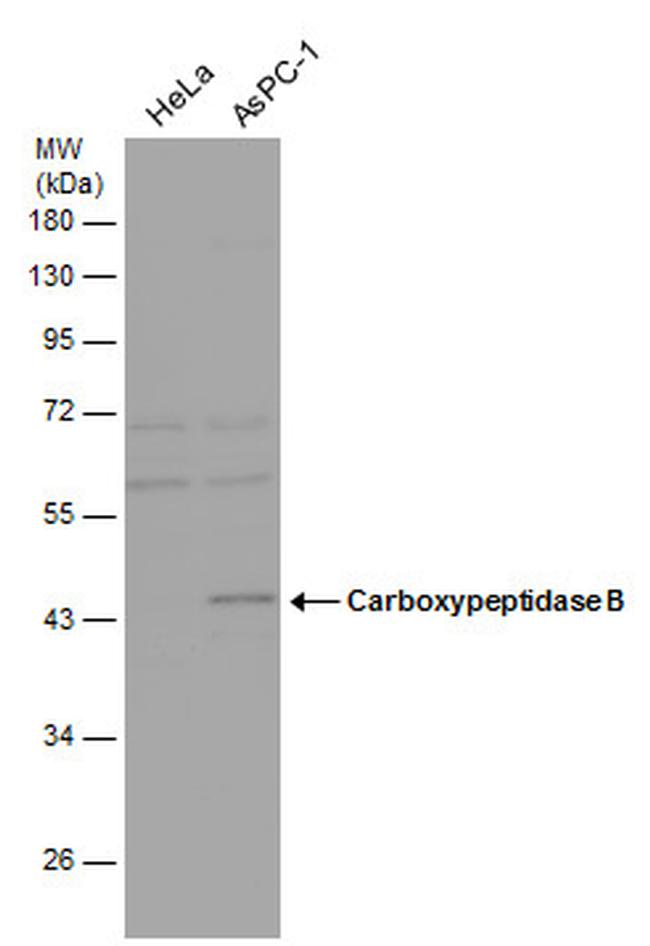 Carboxypeptidase B1 Antibody in Western Blot (WB)