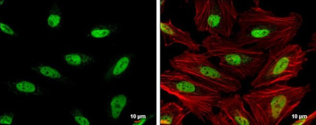 OCT1 (POU2F1) Antibody in Immunocytochemistry (ICC/IF)