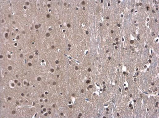 OCT1 (POU2F1) Antibody in Immunohistochemistry (Paraffin) (IHC (P))