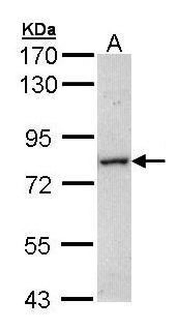 MTMR14 Antibody in Western Blot (WB)