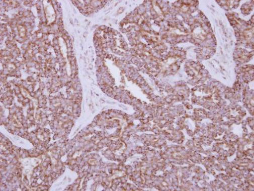 HK1 Antibody in Immunohistochemistry (Paraffin) (IHC (P))