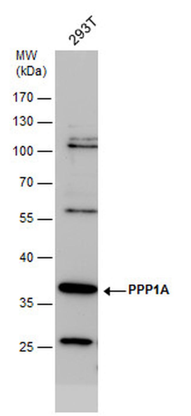 PP1 alpha Antibody in Western Blot (WB)