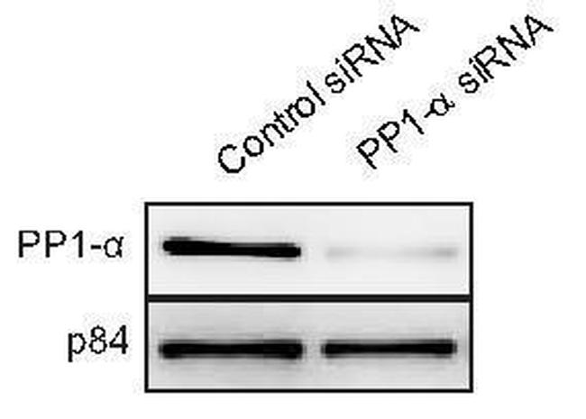 PP1 alpha Antibody in Western Blot (WB)