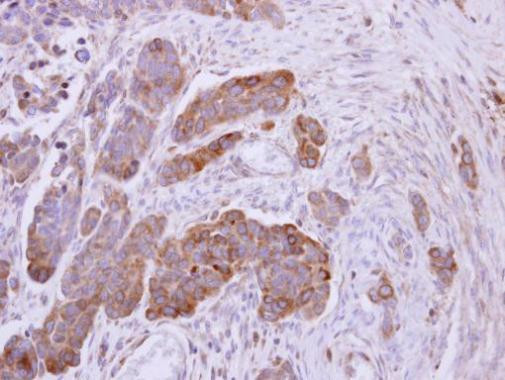 NDUFS1 Antibody in Immunohistochemistry (Paraffin) (IHC (P))