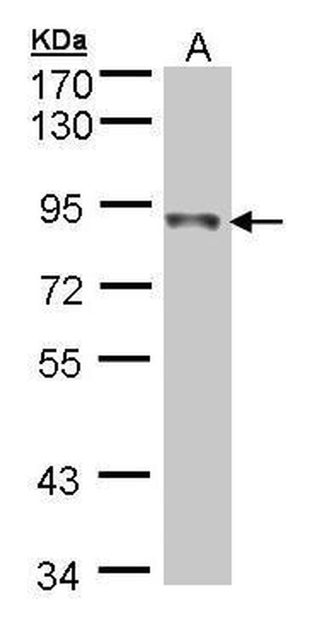 NDUFS1 Antibody in Western Blot (WB)