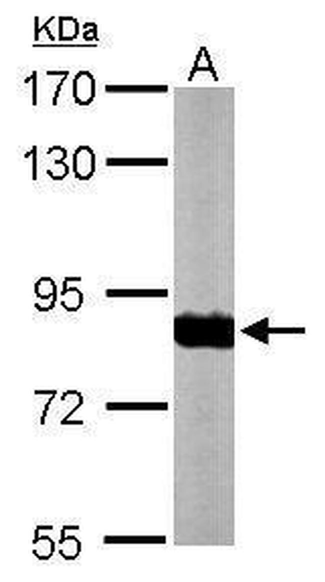 NDUFS1 Antibody in Western Blot (WB)