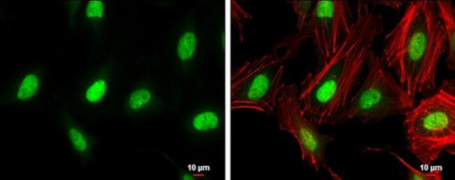 ZEB1 Antibody in Immunocytochemistry (ICC/IF)