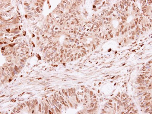 SKAP55 Antibody in Immunohistochemistry (Paraffin) (IHC (P))