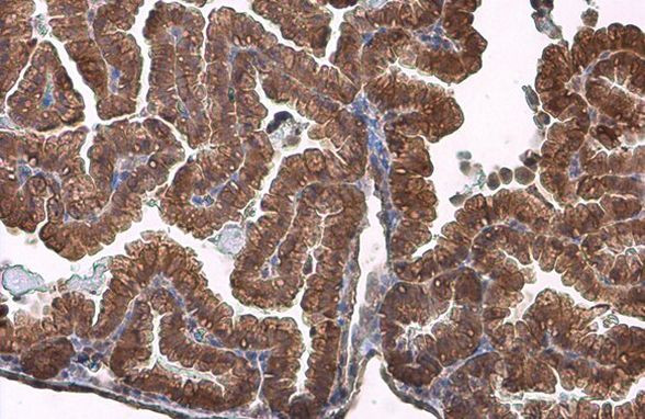 ACVR2B Antibody in Immunohistochemistry (Paraffin) (IHC (P))