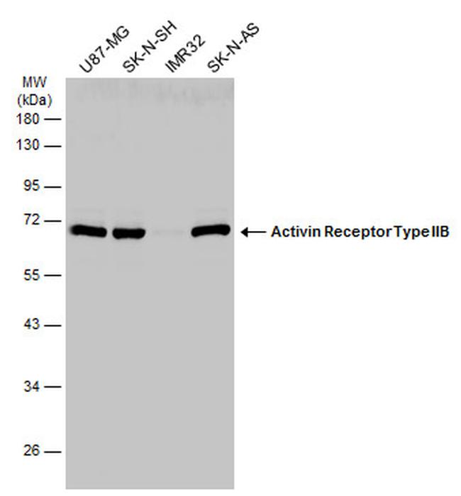 ACVR2B Antibody in Western Blot (WB)