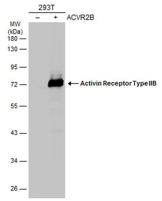ACVR2B Antibody in Western Blot (WB)