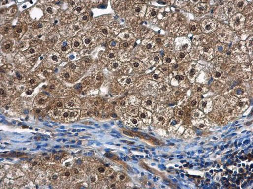 PSMC5 Antibody in Immunohistochemistry (Paraffin) (IHC (P))