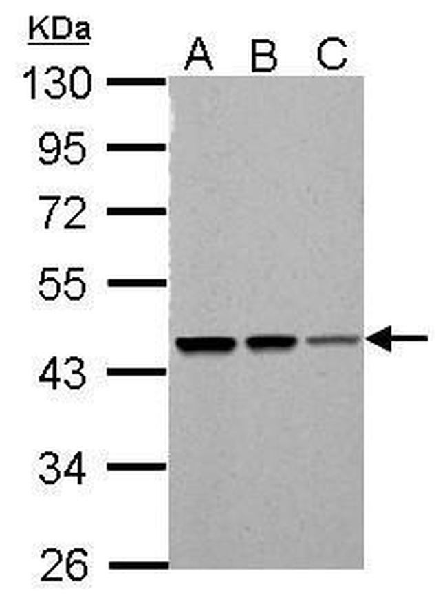 PSMC5 Antibody in Western Blot (WB)