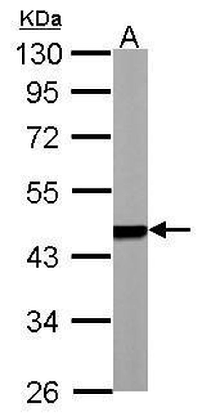 PSMC5 Antibody in Western Blot (WB)