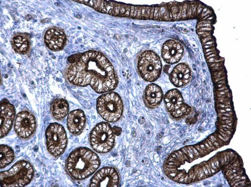 Cytokeratin 6 Antibody in Immunohistochemistry (Paraffin) (IHC (P))