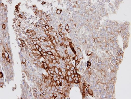 Cytokeratin 6 Antibody in Immunohistochemistry (Paraffin) (IHC (P))