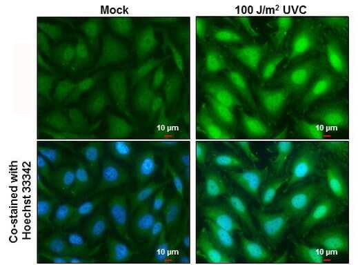 XPD Antibody in Immunocytochemistry (ICC/IF)