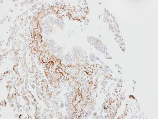 SGLT1 Antibody in Immunohistochemistry (Paraffin) (IHC (P))