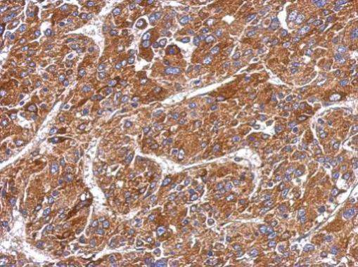 MMP8 Antibody in Immunohistochemistry (Paraffin) (IHC (P))