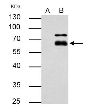 MMP8 Antibody in Immunoprecipitation (IP)