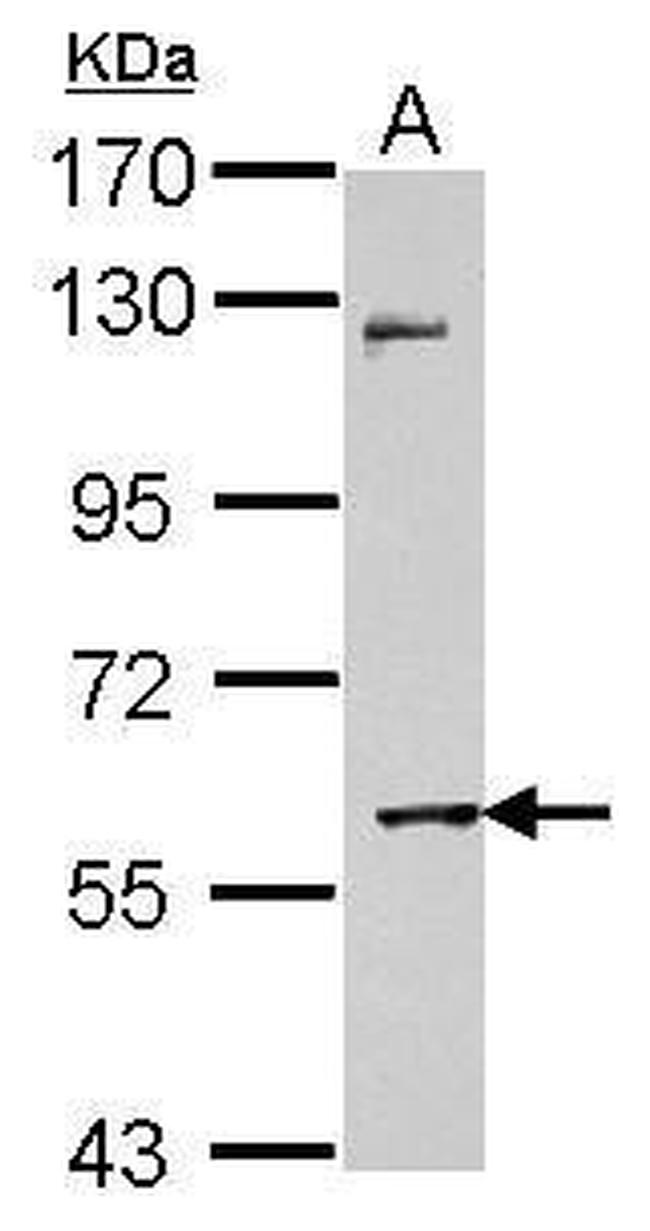 MMP8 Antibody in Western Blot (WB)