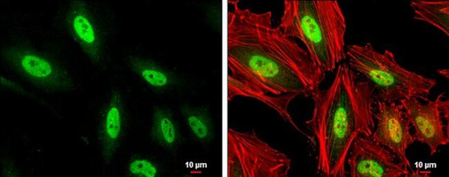 MEF2C Antibody in Immunocytochemistry (ICC/IF)