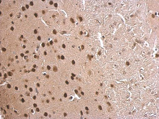 MEF2C Antibody in Immunohistochemistry (Paraffin) (IHC (P))