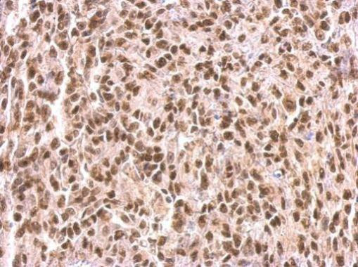 MEF2C Antibody in Immunohistochemistry (Paraffin) (IHC (P))