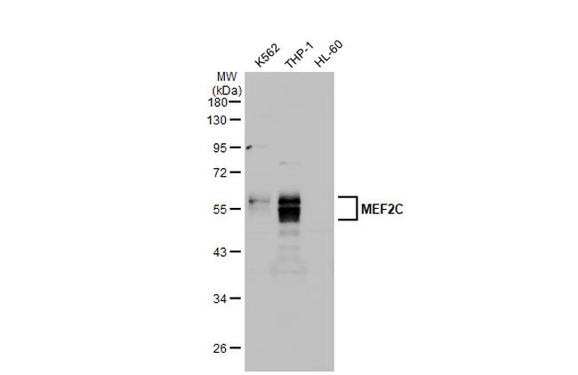 MEF2C Antibody in Western Blot (WB)